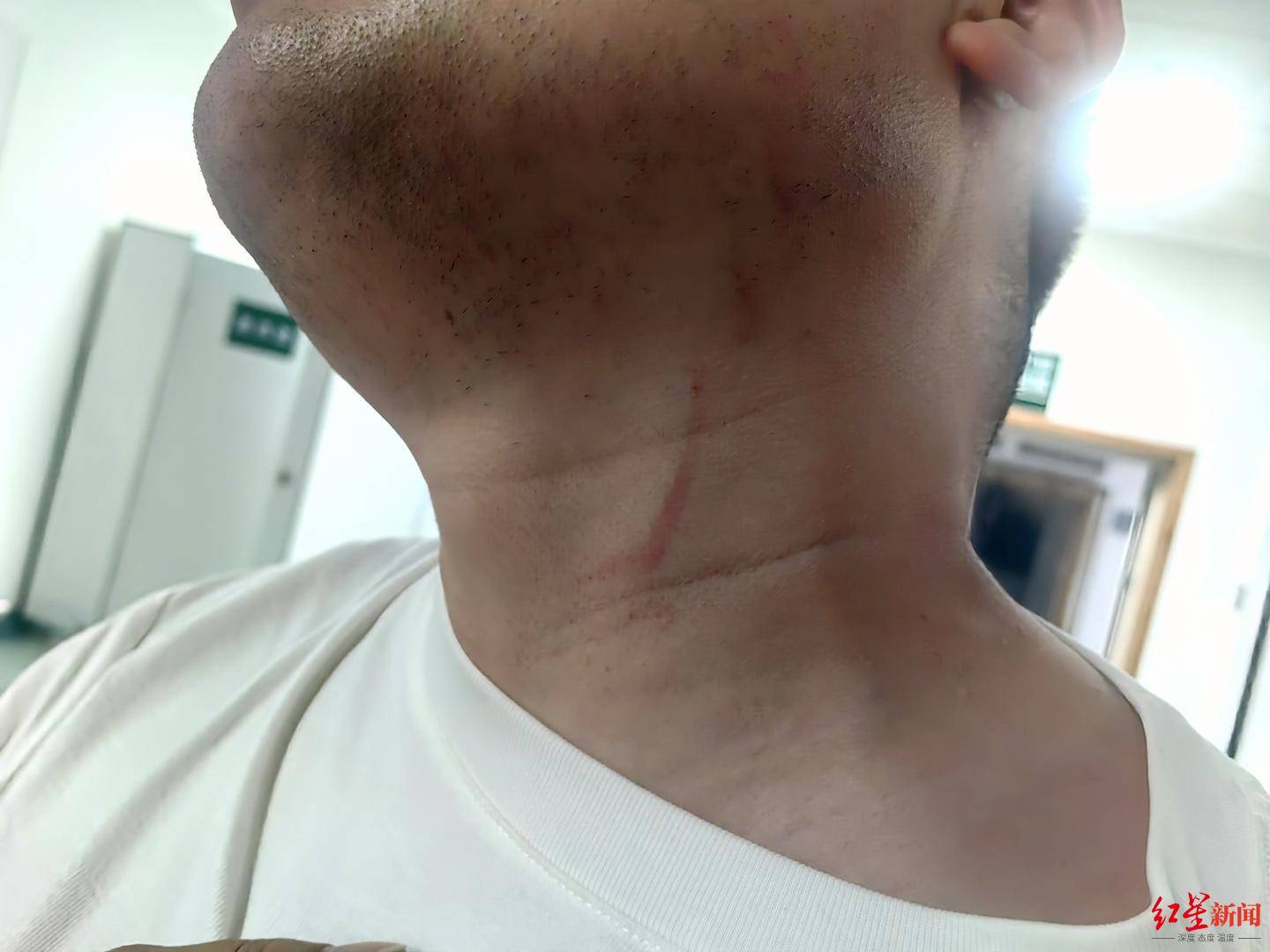 武汉男子拍摄违停时被当街殴打,打人者被罚款500元,被打者称将提起行政复议并起诉